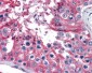 TUBA4A / TUBA1 Antibody (clone 2E11)